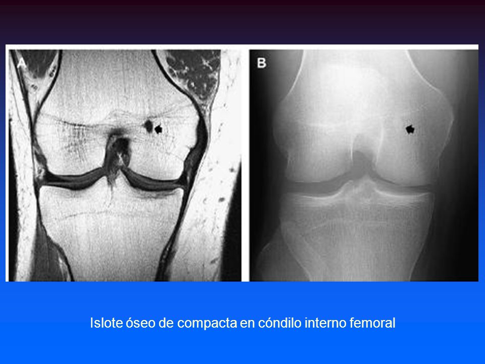 Si es posible aumentar el miembro viril y como
